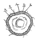 -cyst illustration